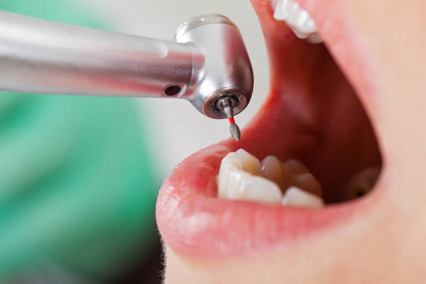 Best Emergency Broken Tooth Repair in East Farmingdale, NY